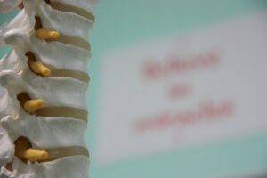 spine nerves plastic model