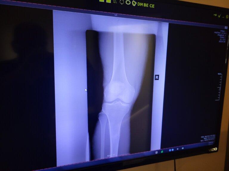 Digital Xray- Fuji-Konica Minolta-20/20 Imaging DR System