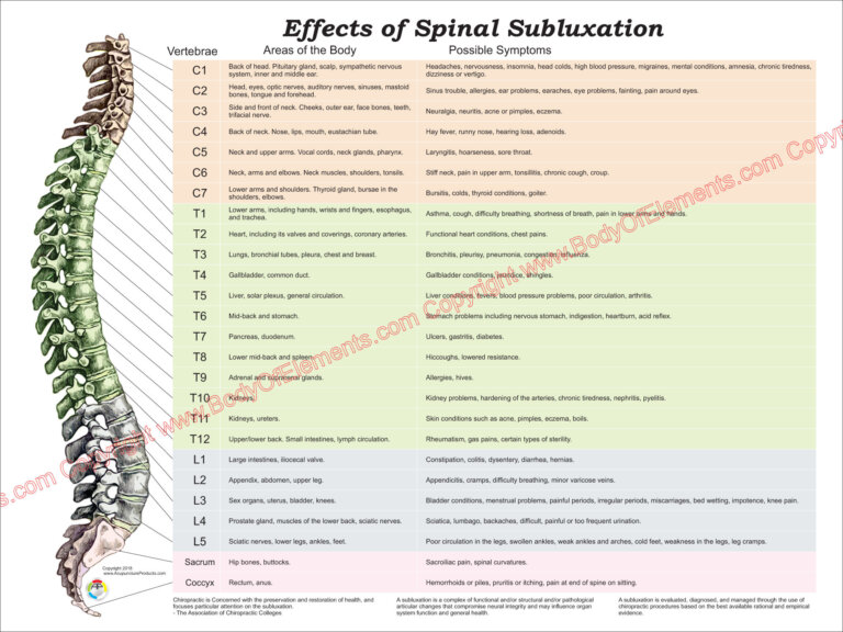 Effects of Spinal Subluxation Poster 18 X 24