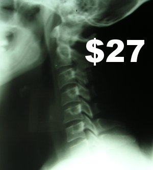 $27 X-Ray and Spinal Examination