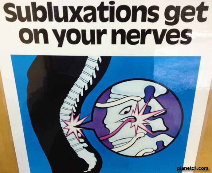 nerves subluxations