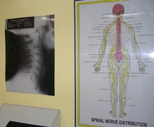 Spinal Nerve Xray Posters