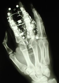 X-Ray-WikiSleuth